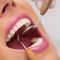 Igiene dentale una buona abitudine per un sorriso sano