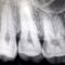 Radiografie endorali Valsamoggia