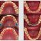 Apparecchio denti Valsamoggia e ortodonzia adulti e bambini