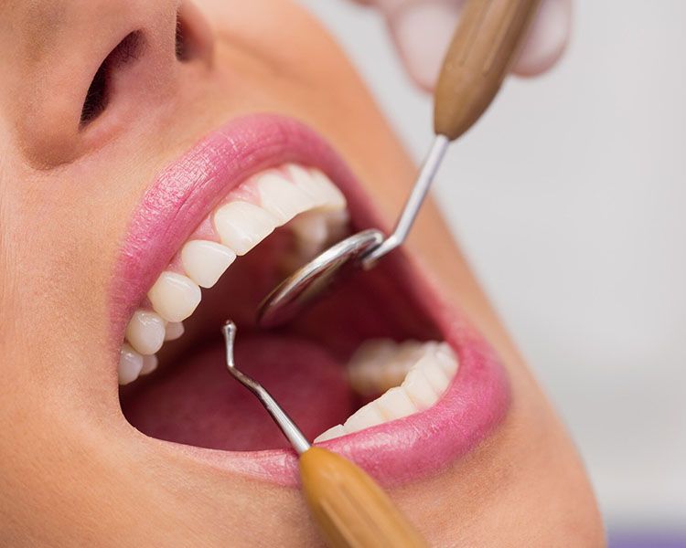 Igiene dentale una buona abitudine per un sorriso sano
