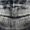 Panoramica dentale Valsamoggia