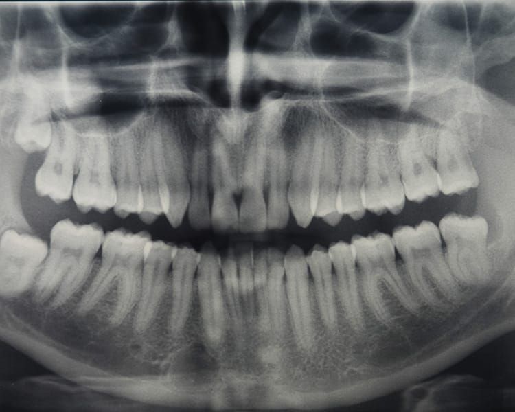 Panoramica dentale Valsamoggia