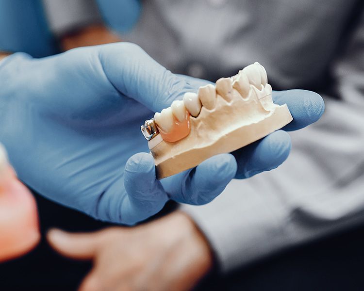 Riparazione protesi dentale Valsamoggia presso Dentosan
